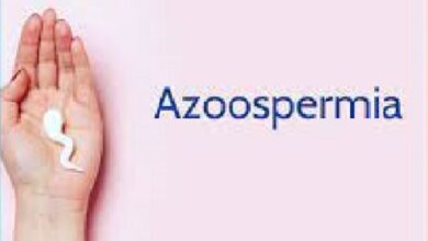 Azoospermia