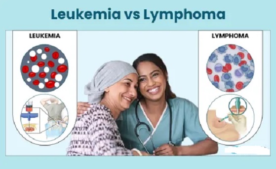 Difference between leukemia and lymphoma Similarities and FAQs