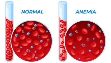 Anemia vs Low iron